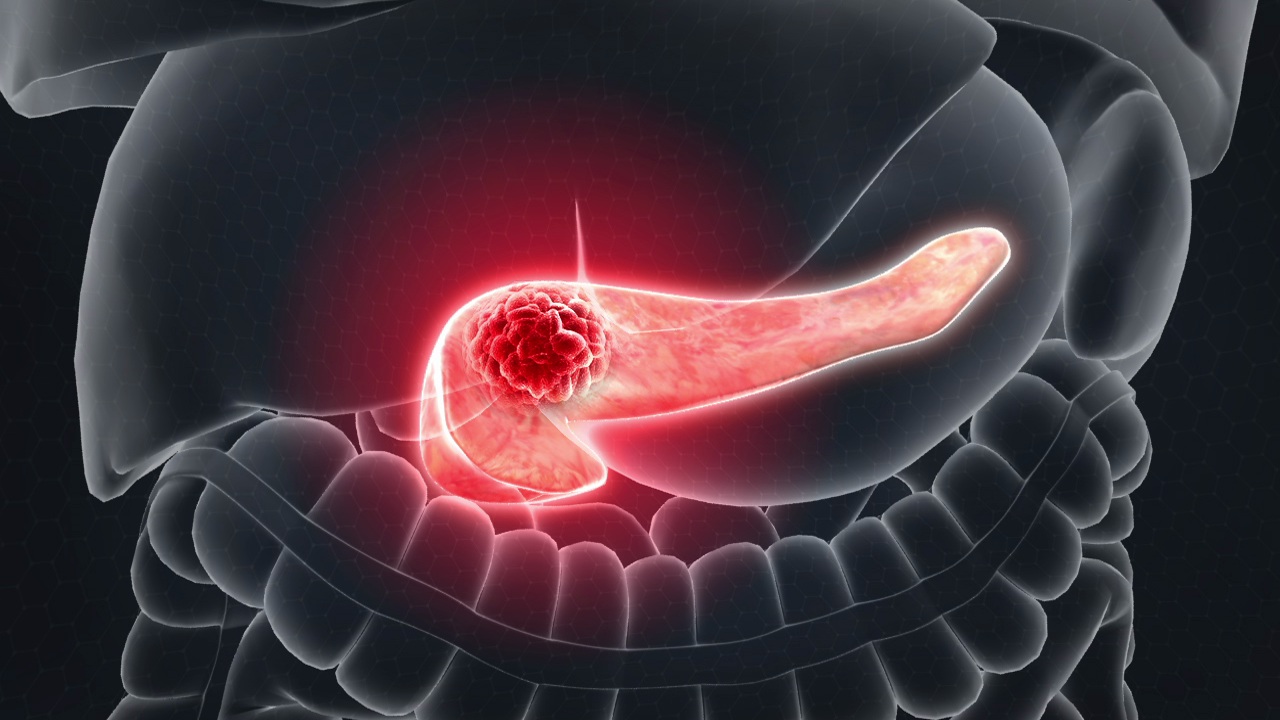 cl-nica-oncolog-a-integrativa-nanotermia-oncothermia-oncolog-a